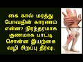 கை கால் மரத்து போதல் காரணமும் தீர்வும் | Home Remedies for Numbness In Hands & Legs in Tamil