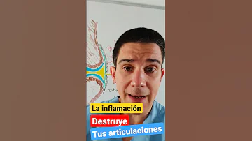 ¿Puede el Crohn hacer que te duelan las articulaciones?