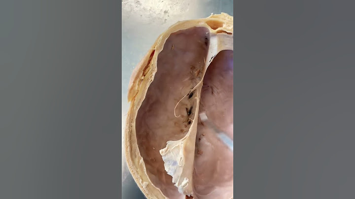 What’s Inside This REAL Human Skull?