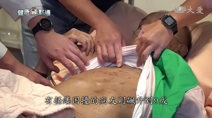 尿毒搔痒症 中西医携手治疗 - 天天要闻