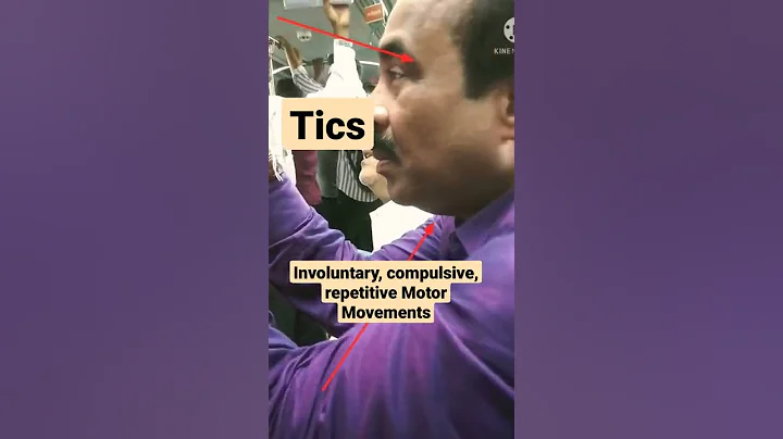 Tics- Involuntary, compulsive, repetitive motor movements #mbbs #medicine #neetpg #neet #usmle