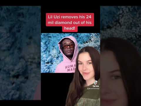 Lil Uzi Removes 24 Million Dollar Diamond From His Head!