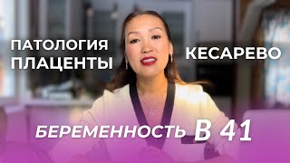 Готовлюсь к кесарево из-за предлежания плаценты. 3 триместр