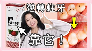 『幫牙齒補鈣』逆轉蛀牙 抗敏感 全靠MI Paste | 不知道的人 吃大虧了 @DrTeresa