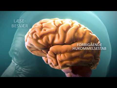 Video: For Første Gang Var Det Muligt At Neutralisere Alzheimers-genet I Cellerne I Den Menneskelige Hjerne - Alternativ Visning