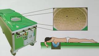 Campus-Tv - Mammographie Per Ultraschall