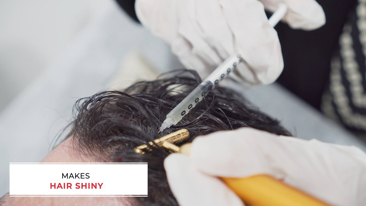 PRP Hair Restoration at Venus Aesthetics | Boost Hair Growth Naturally