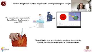 Domain Adaptation and Self Supervised Learning for Surgical Margin Detection