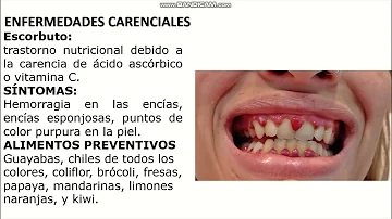 ¿Cuáles son las 5 enfermedades carenciales?