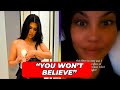 Health Hack or Hype? Kourtney Kardashian's Breast Milk Secret Exposed