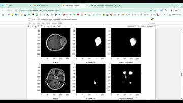 MRI Brain  Image Segmentation using CNN in Python Projects