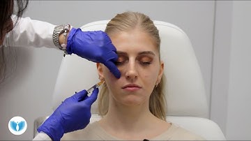 Tear Trough Filler, Watch Full Video