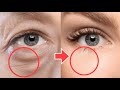 Anti-Aging Face Exercises For Eye Bags, Eye Wrinkles, Dark Circles Under Eyes | No Surgery!