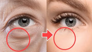 AntiAging Face Exercises For Eye Bags, Eye Wrinkles, Dark Circles Under Eyes | No Surgery!