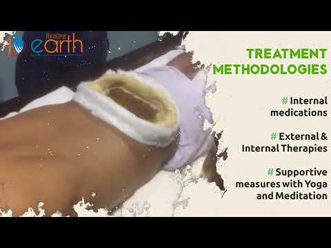 Recovery Journey with Ayurvedic Treatment