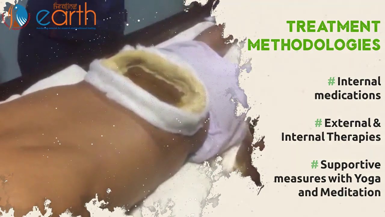 What Our Patient Say Video Testimonial