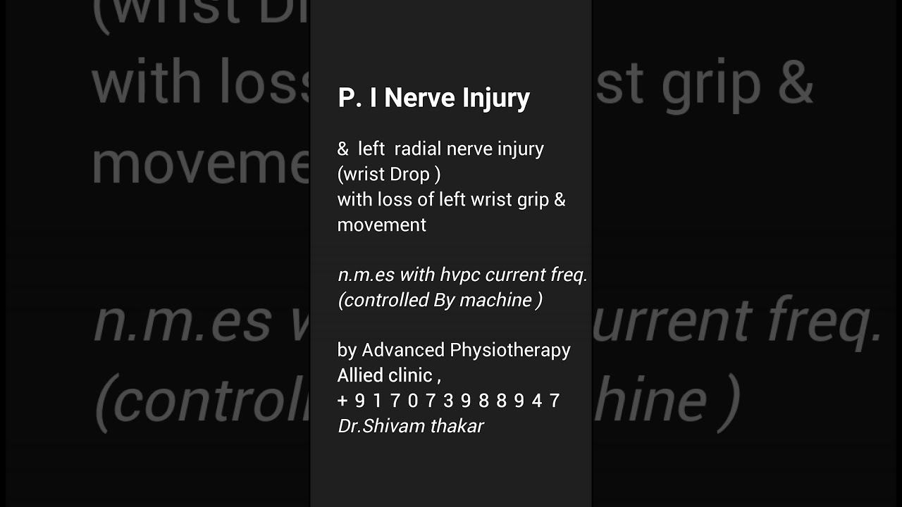 wrist drop recovery by advanced physiotherapy at allied clinic , mehsana by Dr.shivam thakar