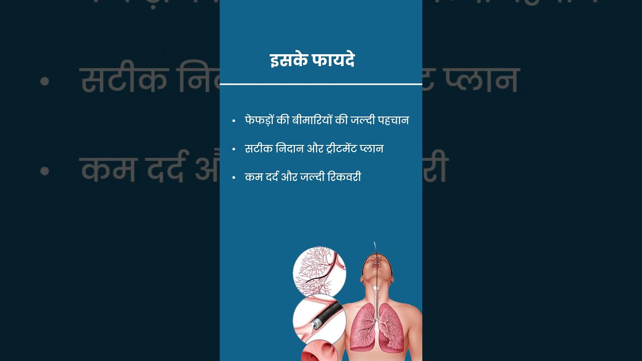 Bronchoscopy | Advanced Lung Care in Dhanbad | Dr Akash Deep
