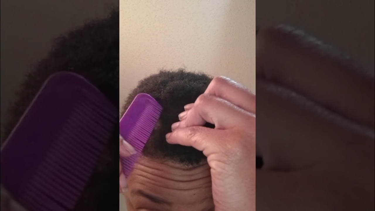 NEW DANDRUFF SCRATCH & REMOVAL!!!!