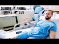 OPEREI A MINHA PERNA QUEBRADA | MY BROKEN LEG WAS FIXED (w/ english subtitles)