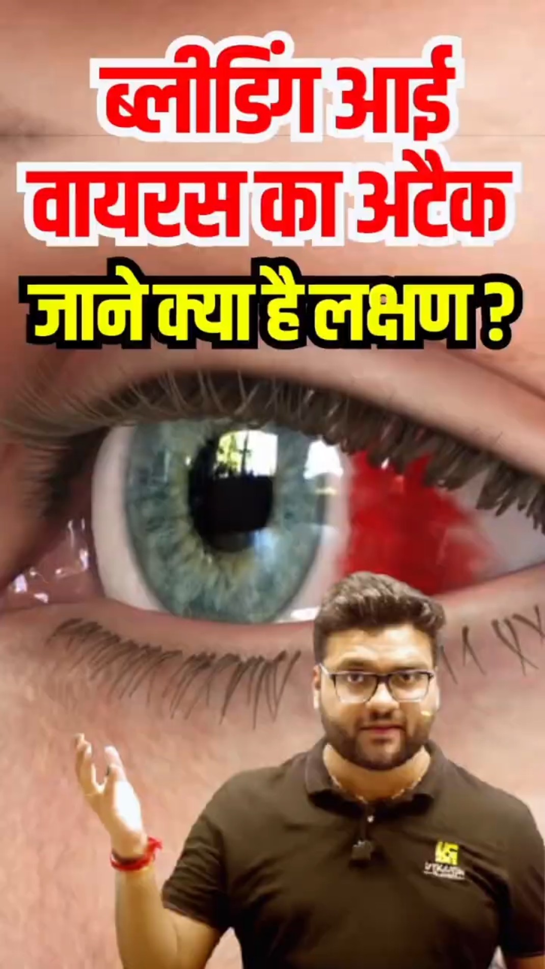 ब्लीडिंग आई वायरस का अटैक?? #kumargauravsir #utkarshclasses