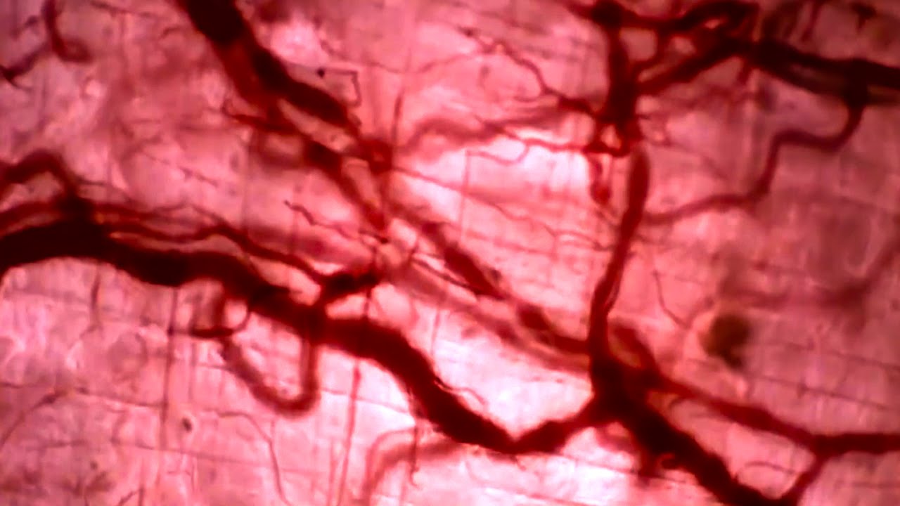 vasodilation bright field microscopy youtube bright field microscopy