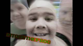 Ddd Um Pra Sua Tia Imtoddthefrog Vs Via Embratel