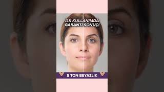 Bembeyaz Kararmasız Cildin Sırrı Imı Yorumda