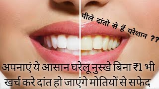 दांतों को सफेद करने के लिए घरेलू नुस्खे ।। home remedies to whiten teeth