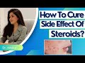 (Hindi ) How to cure side effects of steroids