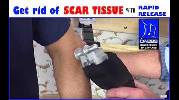 How to get rid of SCAR TISSUE with Rapid Release High Frequency Vibration