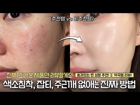 <strong>cc</strong>) 기미,잡티,주근깨 없애는 진짜 <strong>방법</strong>‼️ (약국템,피부과추천템,올영템비교)ㅣ아랑