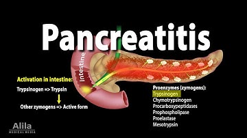 Pancreatitis, Acute and Chronic, Animation