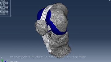 Abaqus knee gait FEA