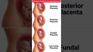 Where Is Your Placenta 🤰? Pregnancy Facts Every Mom Should Know! #pregnancy