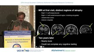 Frontotemporal Dementia - Howard Rosen, MD