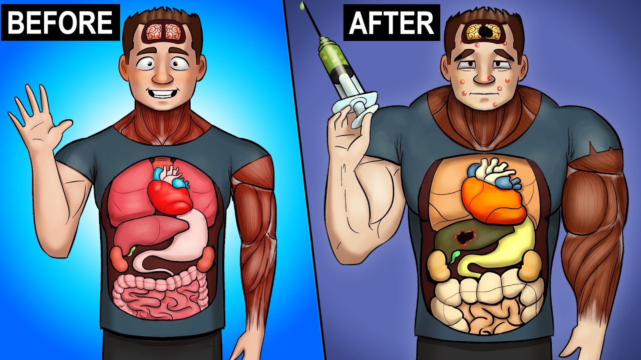 anabolic steroids before and after