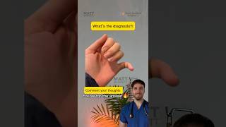 A Bent Pinky? Guess The Diagnosis