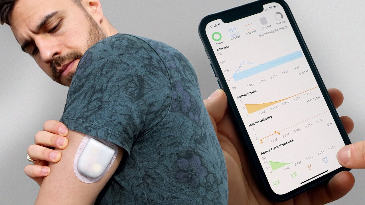 Я использовал Loop для взлома своей инсулиновой помпы.