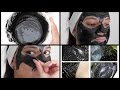 Get Rid Of Unwanted Facial Hair, Blackheads & Whiteheads easily at home | Charcoal Peel off  mask