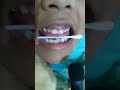apoyo de lenguaje #niños