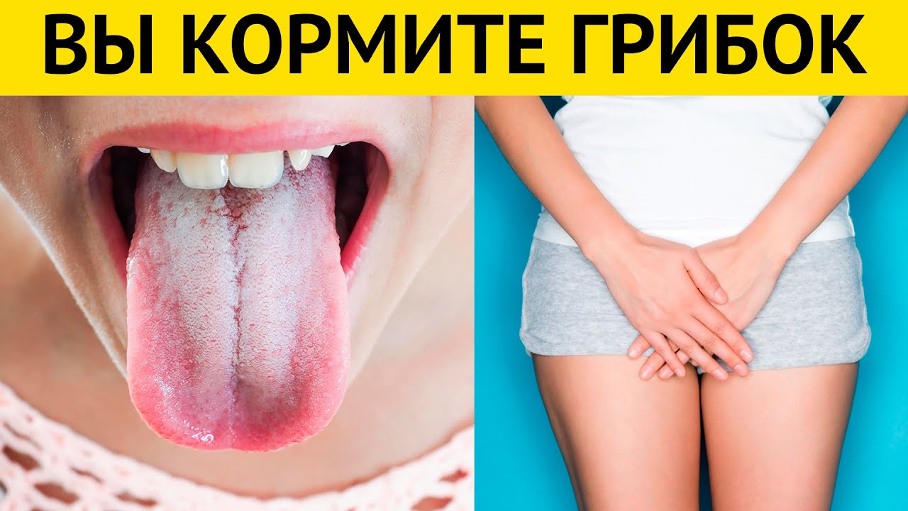 Как избавиться от КАНДИДОЗА, ПЛЕСЕНИ и ГРИБКОВ! Продукты вызывающие ...