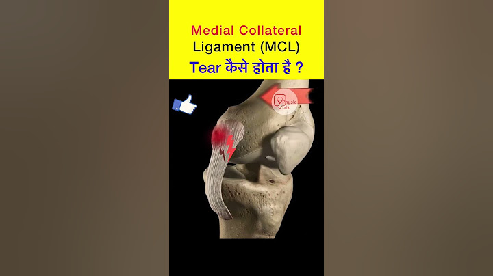Medial collateral ligament tear कैसे होता है ? #shorts #medialcollateralligament #MCL