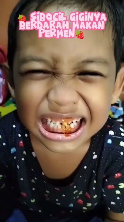 Sibocil gigi nya berdarah makan permen_Mama Agrata Tv #makanemoji #eskrim #farelprayoga