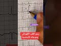 رسم القلب الكهربائي 