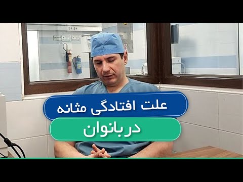 علت افتادگی مثانه در بانوان 