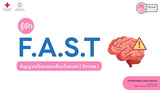 เกร็ดความรู้คู่สุขภาพ | รู้จัก F.A.S.T. สัญญาณโรคหลอดเลือดในสมอง (Stroke)