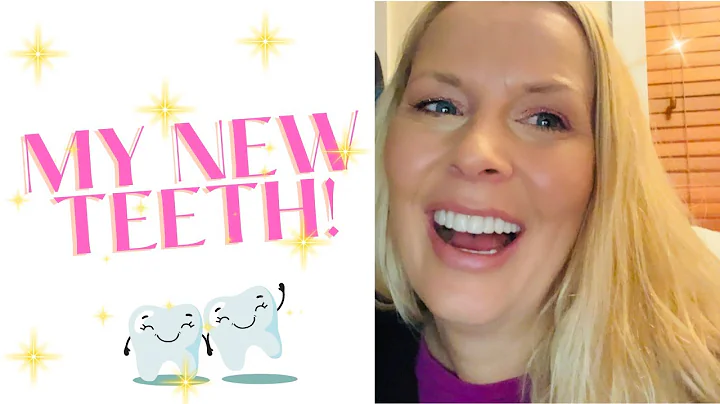 MY DENTAL IMPLANT SURGERY | ALL ON FOUR | ZYGOMATI...