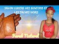 Ref:vjlb8tHimiQ Savon contre des boutons et les taches noirs....