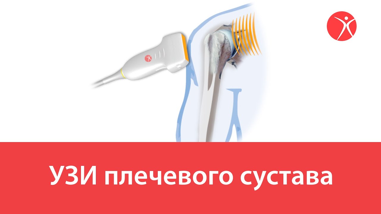 УЗИ плечевого сустава